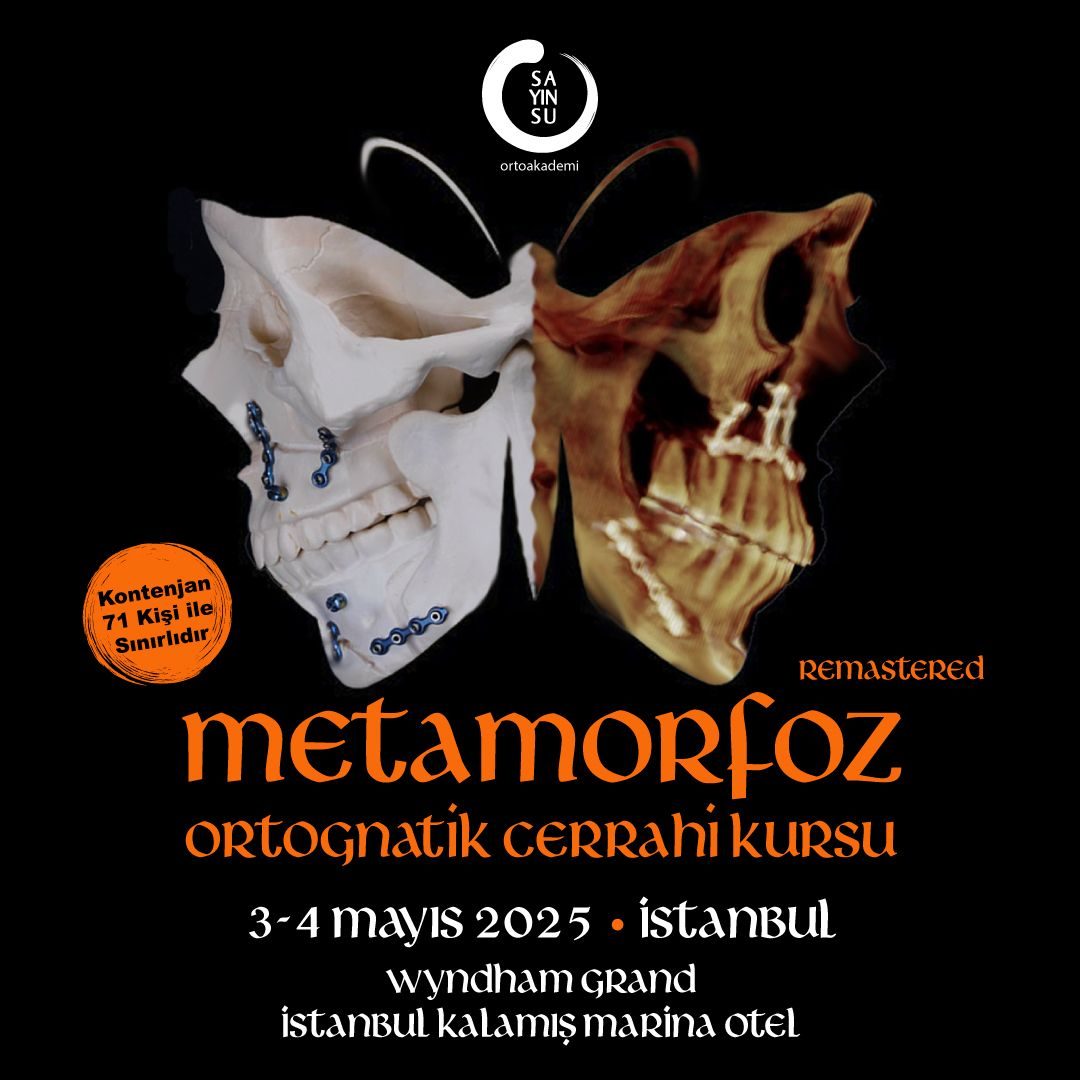 metamorfroz